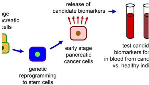 新型胰島癌血液檢測.jpg 新型胰島癌血液檢測.jpg
