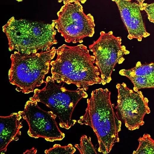 3.webp.jpg 3.webp.jpg