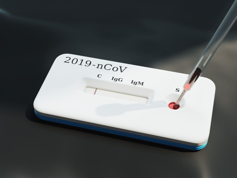 Test Your Personal Immune Response to the Virus That Causes COVID-19