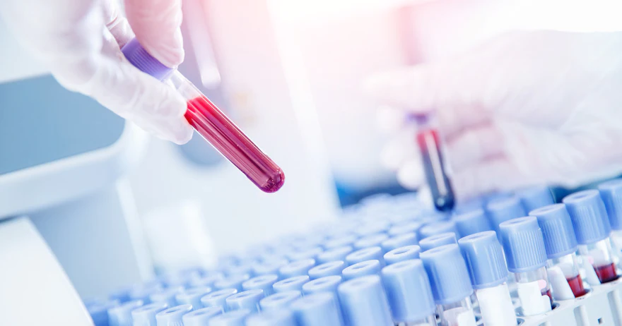 Blood test detects neurometabolic disease to simplify, accelerate diagnosis