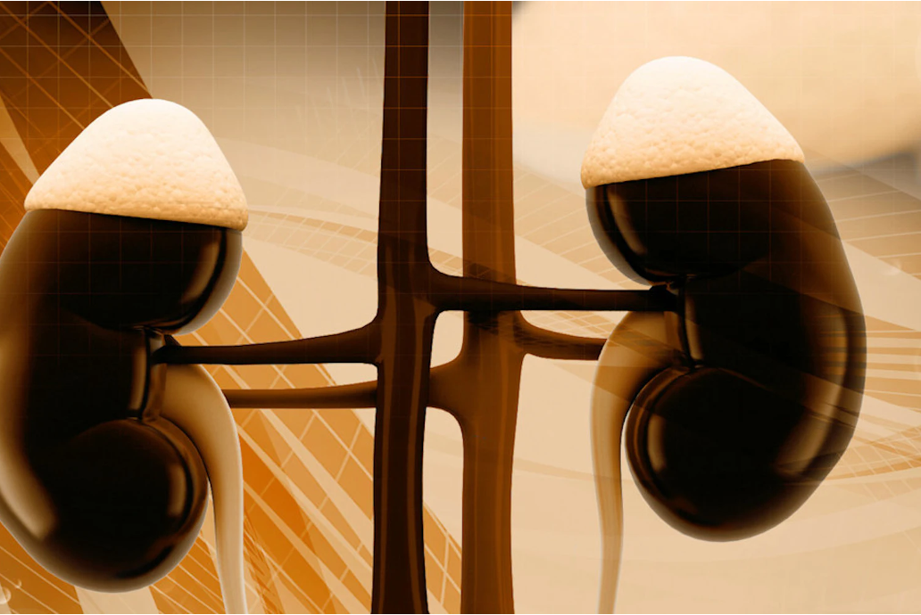 Verici DX, Thermo Fisher Scientific sign licensing agreement on pre-transplant prognostic test