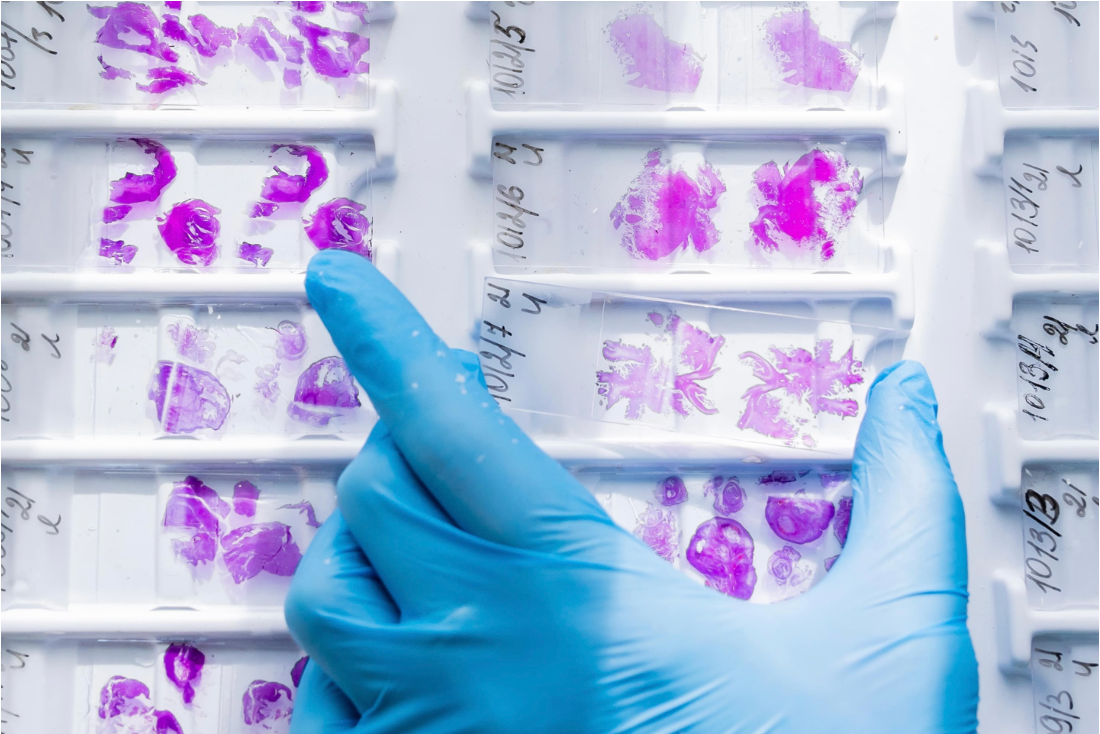 Owkin, MSD Collaborate on Digital Pathology Cancer Diagnostics