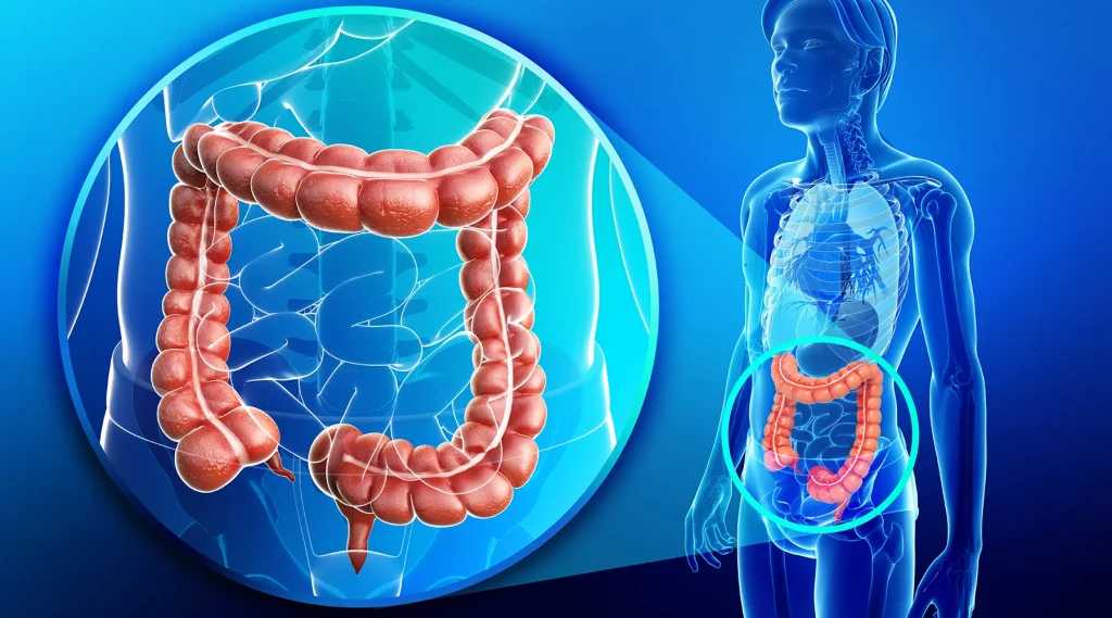 China��s National Health Commission Releases the 2024 Edition of Early Diagnosis and Treatment for Colorectal Cancer