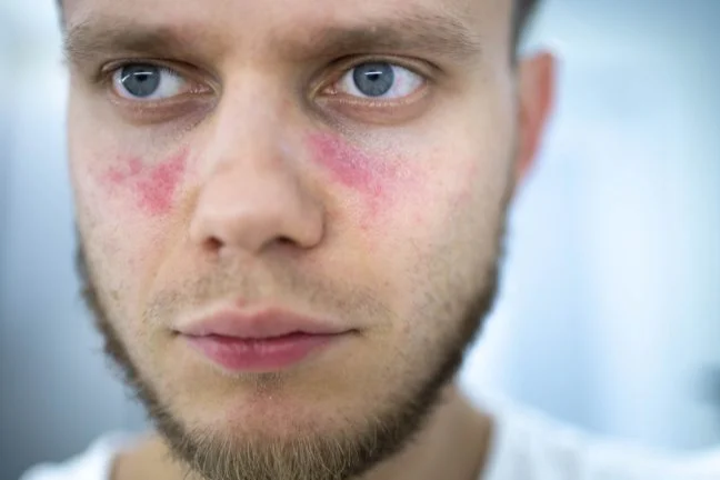 AliveDx gains IVDR CE mark for MosaiQ AiPlex CTDplus assay