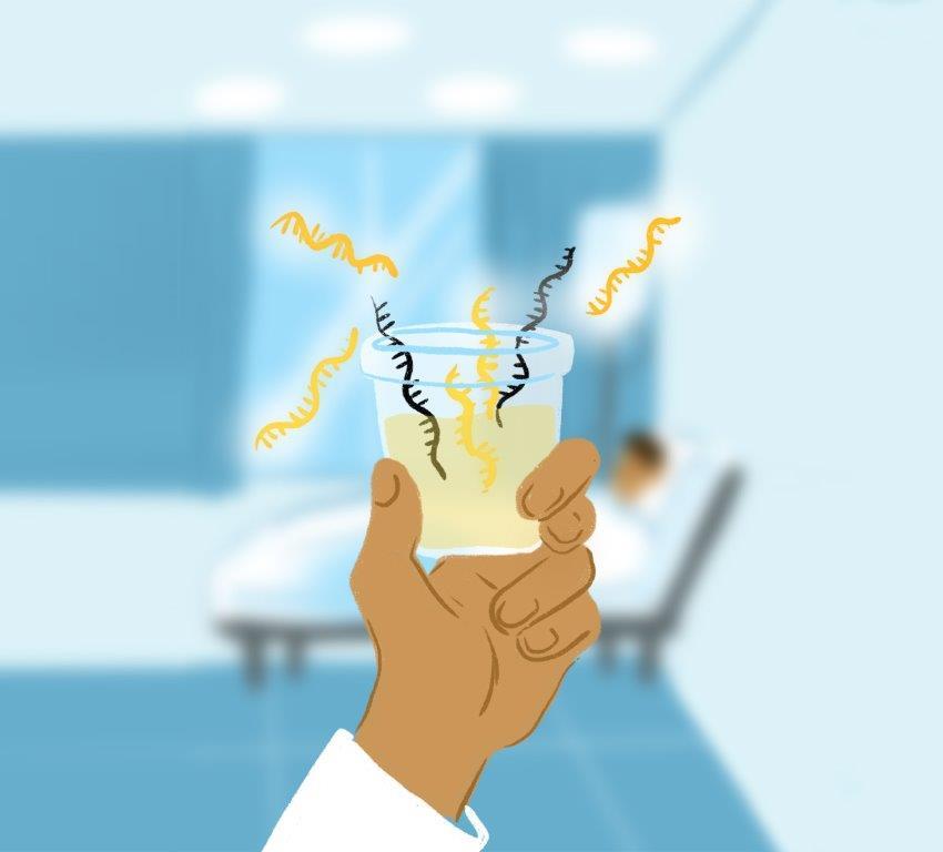 Johns Hopkins Investigators Create New Urine-based Test to ID Prostate Cancers