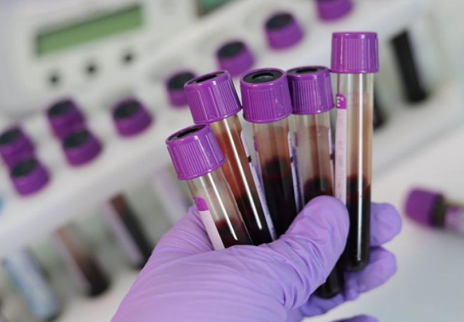 Liquid Biopsy Tests Are Becoming More Mainstream