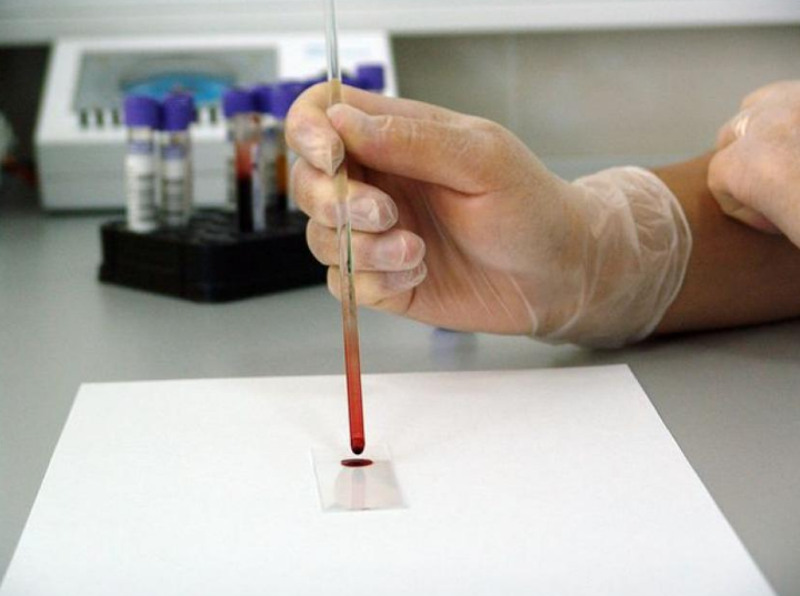 GRAIL��s SUMMIT Will Help Define its Liquid Biopsy Path