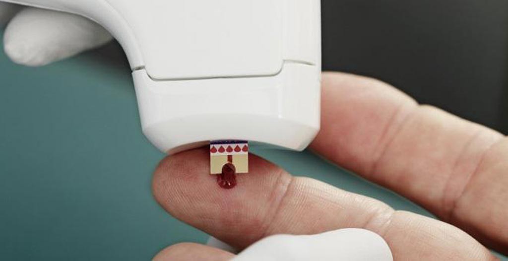  Demand for Coagulation Testing Driving Global Blood Coagulation Analyzer Market 