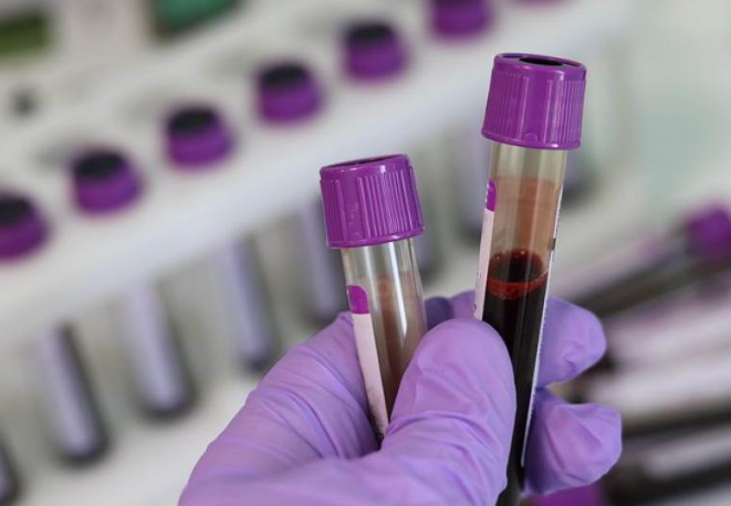 Simple Blood Draw Detects Dangerous Pathogens