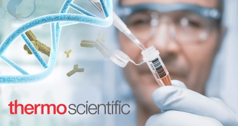 Thermo Fisher deals with ABL