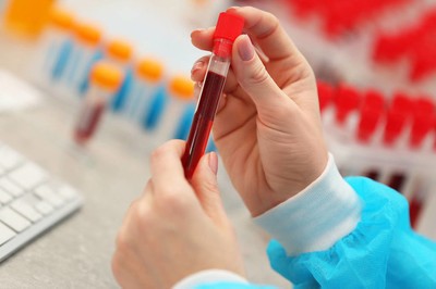 What If a Blood Test Could Predict the Risk of Preterm Birth as Early as the Second Trimester?