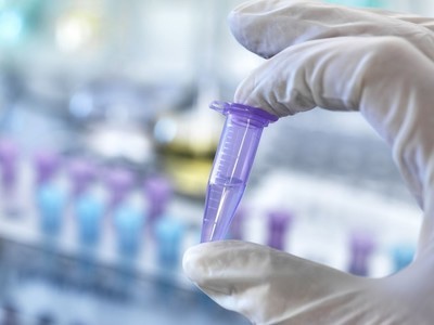 Four Chinese COVID-19 Antigen (home-use) Test Kits Approved by BfArM