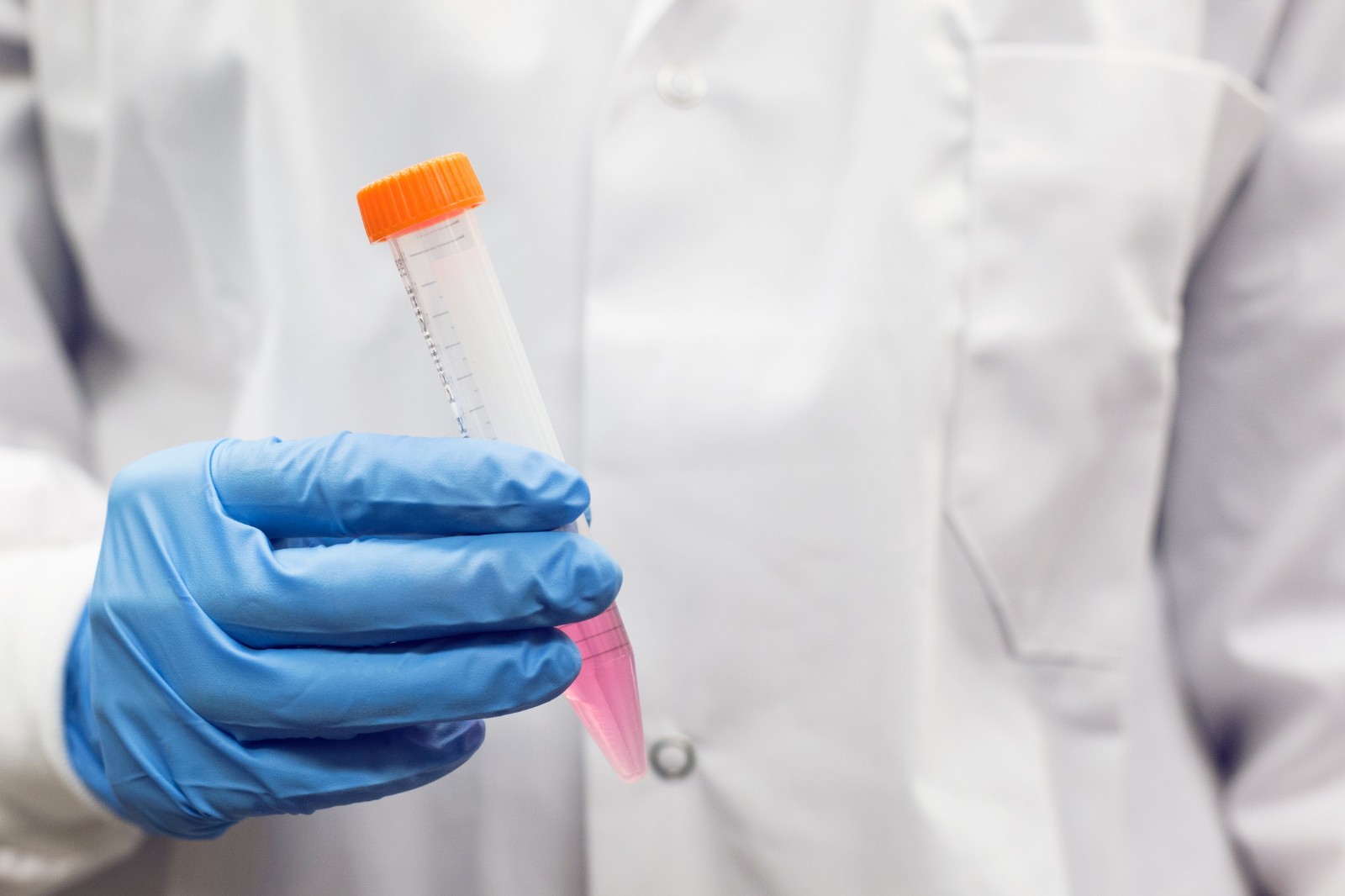 Rapid Tests To Detect Dengue, Zika, Yellow Fever and Other Viruses Validated