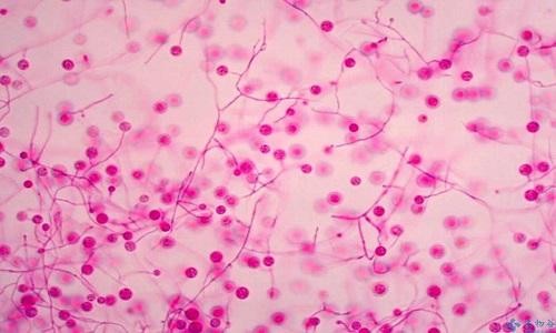 GenMark Fungal Blood Culture Test Clears FDA