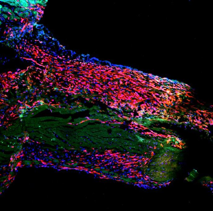 Adult Hearts Lack Cardiac Stem Cells