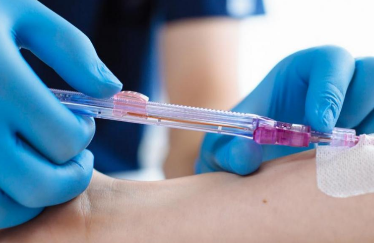 New Vein Access Device Could Benefit Nurses and DIVAs Alike