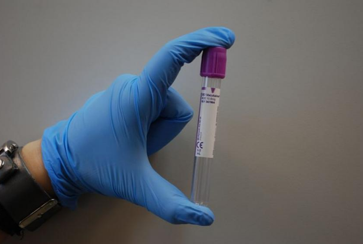 How POC Diagnostics Are Becoming the Norm