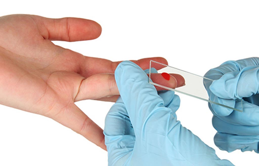 Global POC Diagnostics/Testing Market to Reach USD 22.8 Billion by 2025