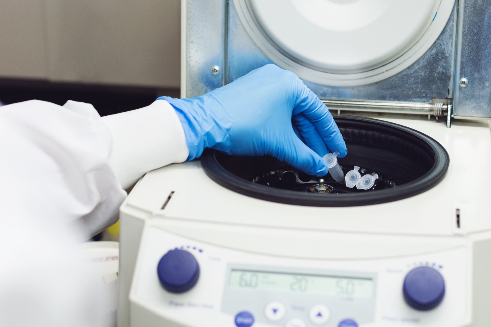 New Method Performs Coronavirus Test 10 Times Faster